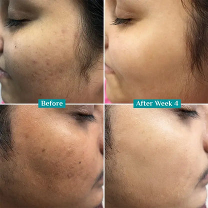 Pilgrim 10% Vitamin C Face Serum — Triple Glow Formula | Brightening + Anti-Dark Spot + Radiance Boost